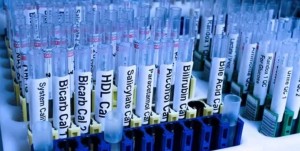 Cuanto tiempo se queda el THC en el cuerpo? foto de prueba Cuanto tiempo se queda el THC en el cuerpo?