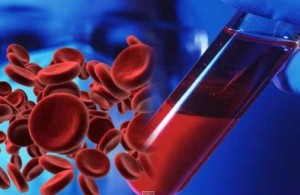 Cuanto tiempo se queda el THC en el cuerpo? foto de thc en la sangre Cuanto tiempo se queda el THC en el cuerpo?